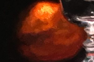 101575-detail2